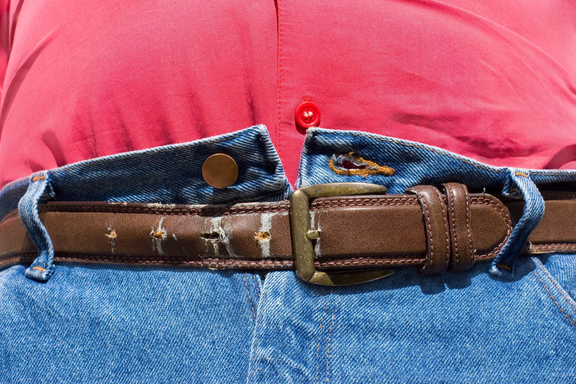 Would You Let Your Child Get Weight Loss Surgery?